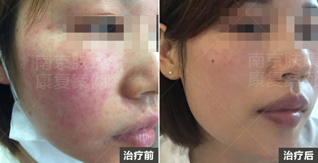 1510906852521760.jpg py1.jpg