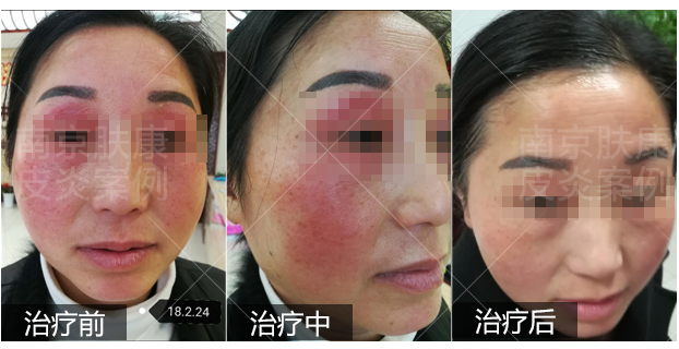 1510906919746644.jpg py2.jpg