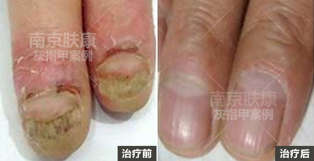 1510909248850264.jpg h2.jpg