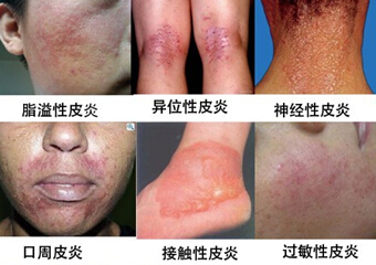 caoyez8478201611269475385642 (1).jpg