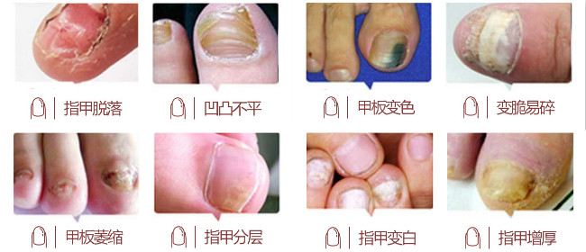 1513675903892307.jpg QQ图片20171219154904_meitu_3.jpg