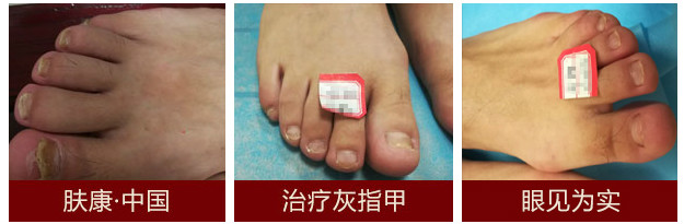 1514273902651759.jpg 1_meitu_3.jpg