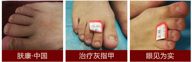 1514871689590568.jpg 1_meitu_1.jpg