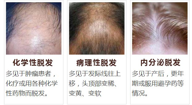 1515835260653781.png 图片2.png