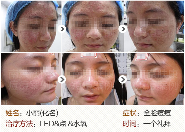 1524795527103792.jpg 620--.jpg