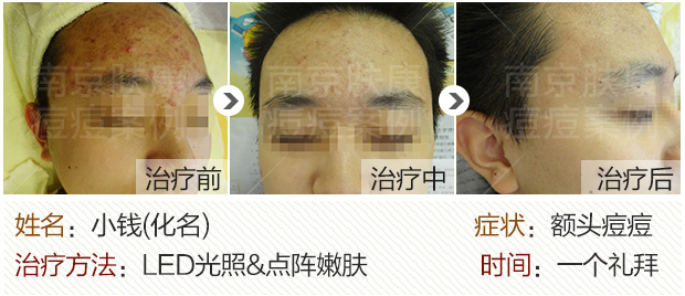 1524795589130859.jpg 620-1.jpg