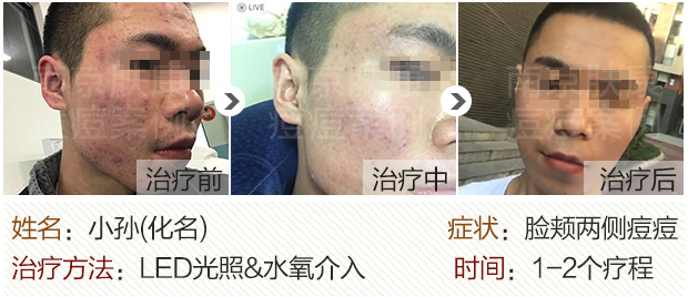 1524795672259911.jpg 620-2.jpg